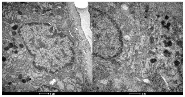 Electron microscopy of parathyroid samples of groups 1 (left) and 2 (right).