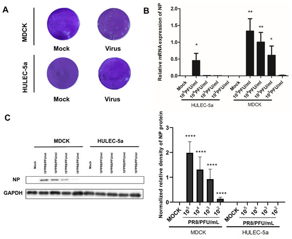 Influenza virus can initiate RNA replication after infecting endothelial cells, but cannot initiate protein replication, and cannot produce progeny viruses.