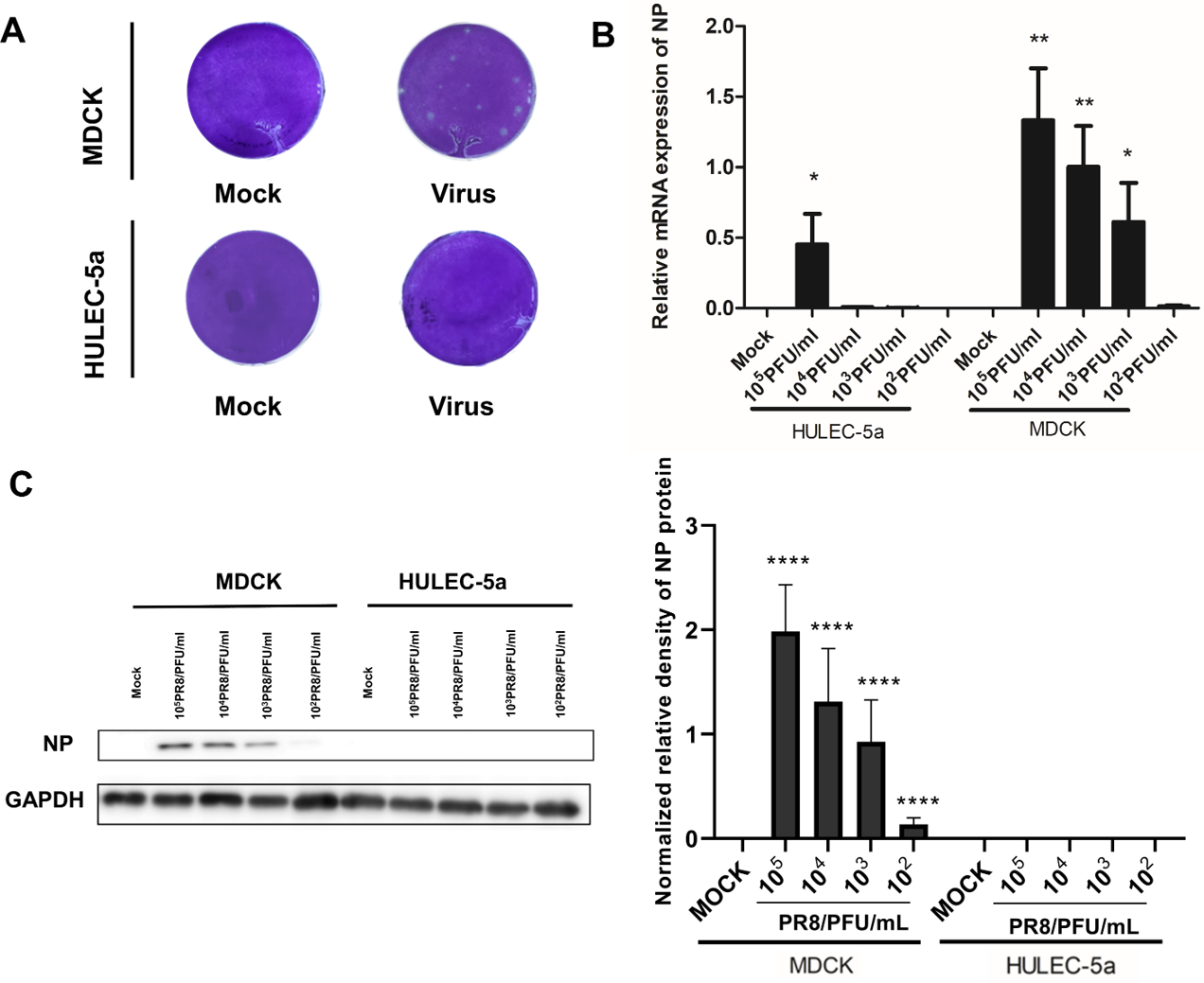 Influenza A virus infects pulmonary microvascular endothelial cells leading  to microvascular leakage and release of pro-inflammatory cytokines [PeerJ]