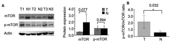 mTOR and p-mTOR expression between ccRCC and adjacent normal kidney tissues by WB analysis.