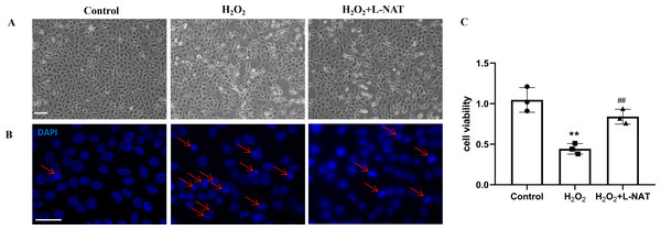 H2O2 induced cell death in BRL cells, while L-NAT protected them from H2O2-mediated cell death.