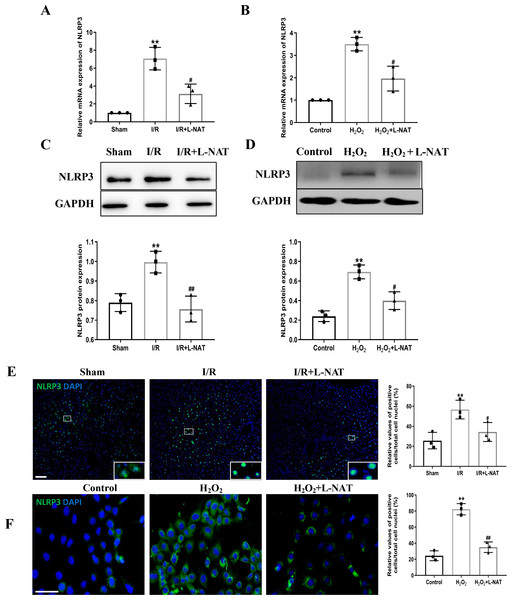 The expression of NLRP3 had a significant up-regulation in HIRI and L-NAT administration rescued the changes of NLRP3.