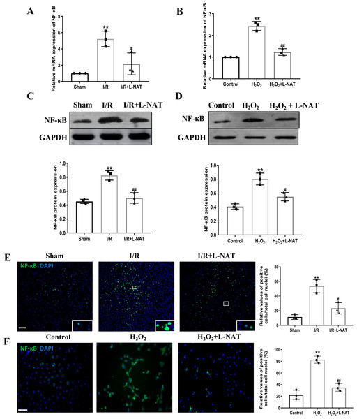Induction of NF-κB in hepatocytes following HIRI was rescued by L-NAT administration.