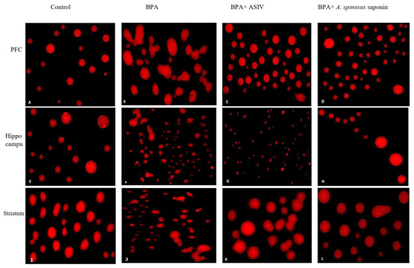 Photomicrographs of DNA damage in the PFC, hippocampal and striatal sections of brain in the studied groups.