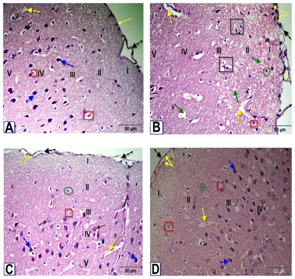 Photomicrographs of coronal sections in the PFC of male rats.