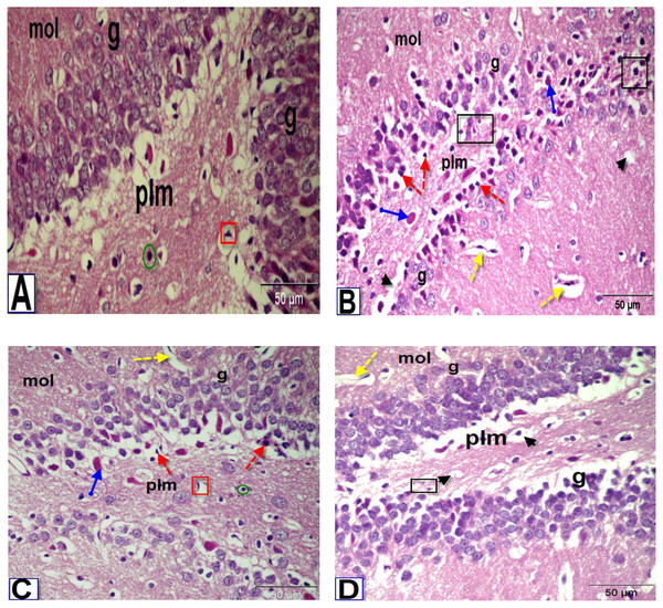 Photomicrographs of coronal sections in the dentate gyrus of male rats.