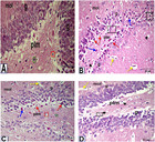 Therapeutic effects of astragaloside IV and Astragalus spinosus ...