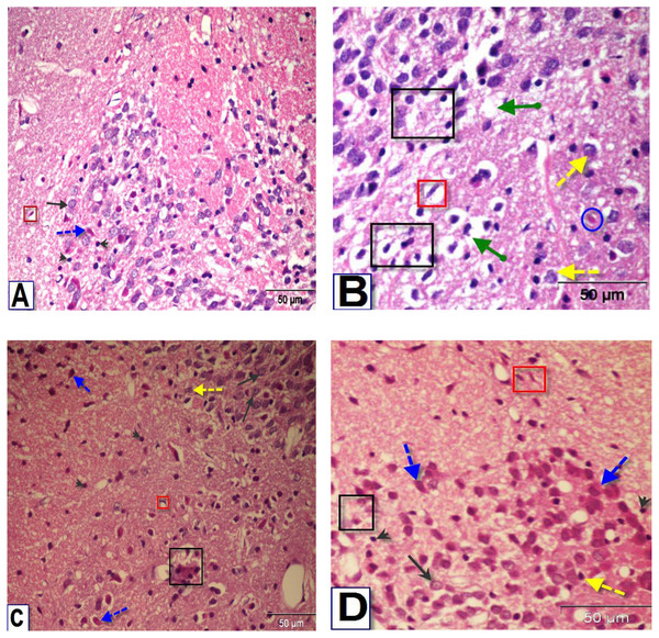 Photomicrographs of coronal sections in the striatum of male rats.