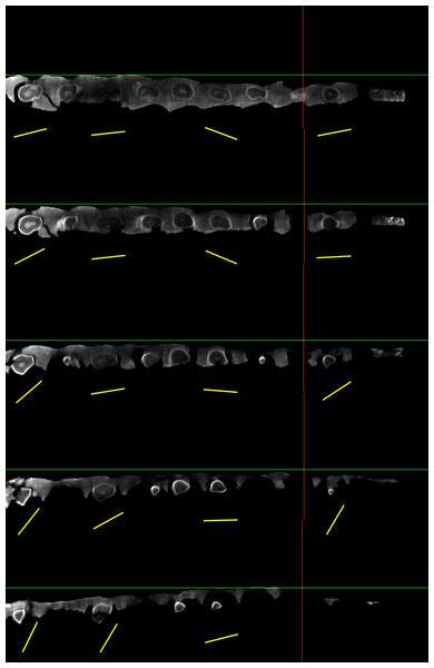 Successive CT slices demonstrating that the mesiodistal axis of the maxillary teeth (yellow bars) of YJDM 00008 are twisted longitudinally.
