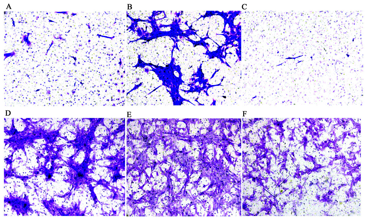Exploring the role of monocyte chemoattractant protein-1 in fibroblast-like  synovial cells in rheumatoid arthritis [PeerJ]