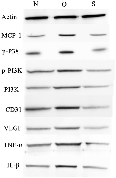 Western blotting assay of MCP-1, p-p38, p-PI3K, PI3K, CD31, VEGF, TNF-α, IL-β following MCP-1 transfection in human FLSs.