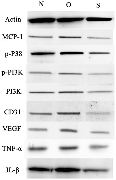Western blotting assay of MCP-1, p-p38, p-PI3K, PI3K, CD31, VEGF, TNF-α, IL-β following MCP-1 transfection in rat FLSs.