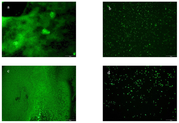 Fluorescence microscopy with biofilm coverslips.