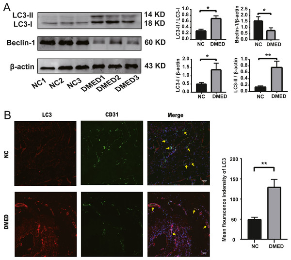 Autophagy increased, and endothelium was injured in the DMED rat model.