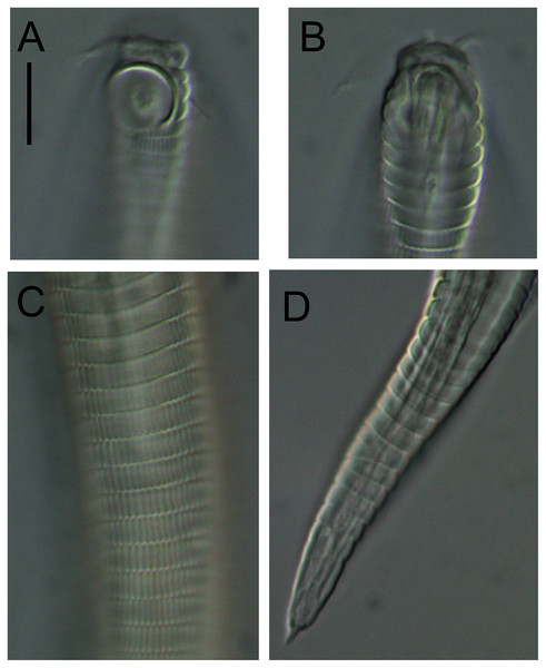 Alaimella aff. cincta Light micrographs of male.