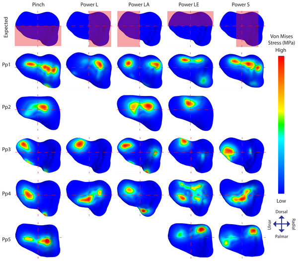 TMC joint Von Mises stress distributions plotted on a distal view of the isolated trapezium distal articular surfaces.