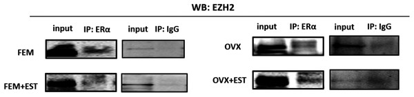 Protein-protein interaction between EZH2 and ERα.
