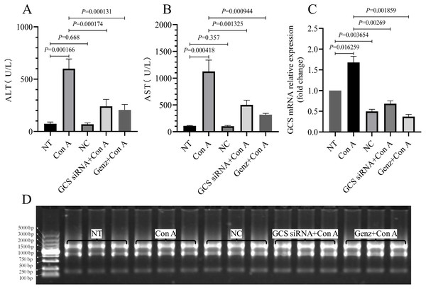 Serum ALT, AST levels and relative expression of GCS mRNA.
