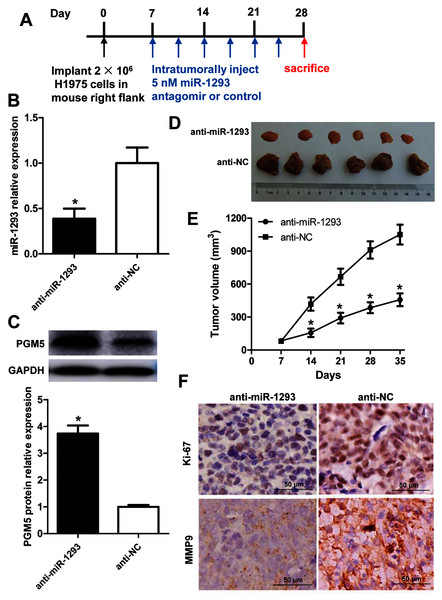 miR-1293 antagomir suppresses LUAD growth and metastasis via negatively modulating PGM5 level in vivo.