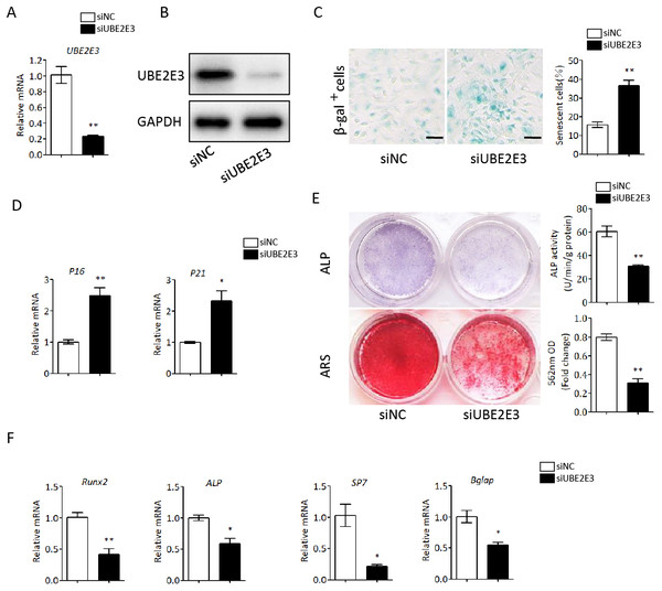 Knockdown of UBE2E3 accelerated cell senescence and inhibited osteogenic differentiation of young BMSCs.