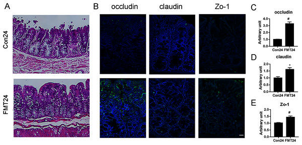 GM from young rats improved the intestinal structure and barrier function in aged rats.