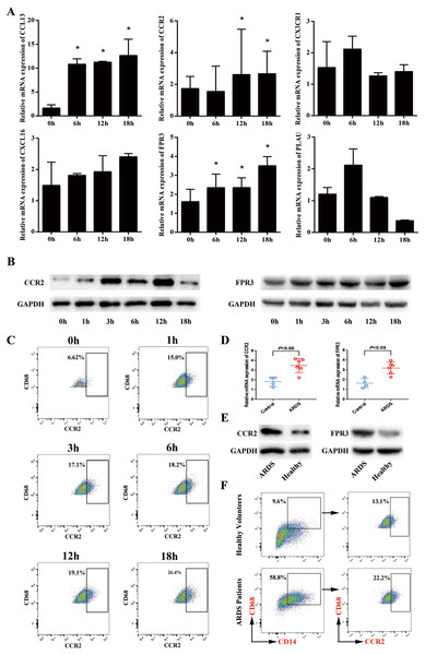 Expression levels of CCR2 and FPR3 in macrophage model of LPS-induced ARDS and primary alveolar macrophages from ARDS patients.
