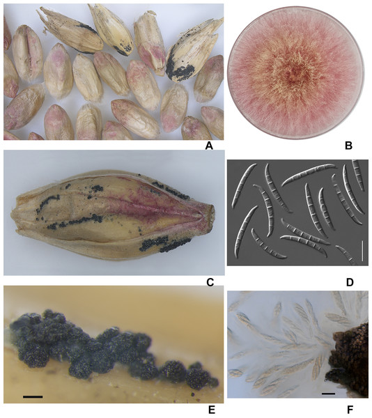 The diseased wheat (A) and barley grains (C); colony of F. graminearum on PSA, 10 days (B); macroconidia F. graminearum (D); the perithecia (E); expulsion of asci and ascospores from the perithecia (F).