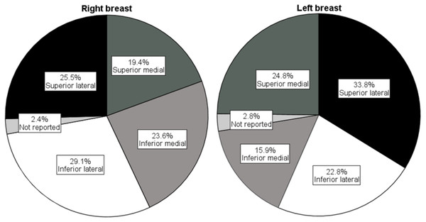 Affected breast quadrants.