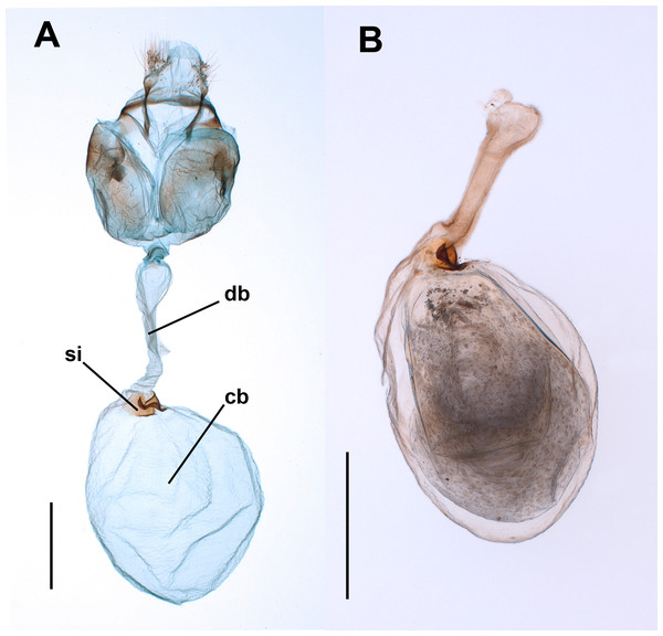 Female genitalia of the butterfly Leptophobiaaripa.