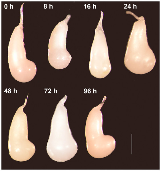 The spermatophores are not digested within the corpus bursae of female Leptophobia aripa butterflies.