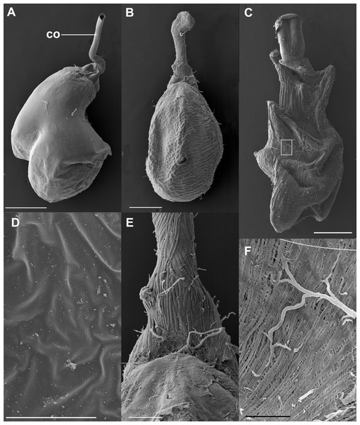 SEM images of the spermatophore, bursa copulatrix and its associated muscles, of the butterfly Leptophobia aripa and the spruce cotton leafworm Spodoptera littoralis.