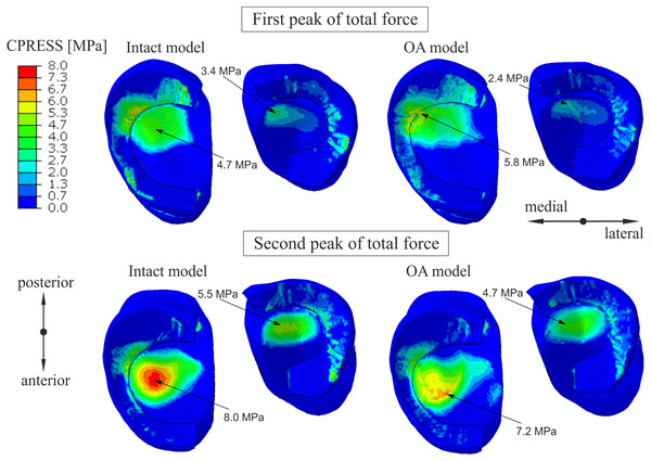 The contour plots of the contact pressure on the tibial articular cartilage and menisci surfaces.