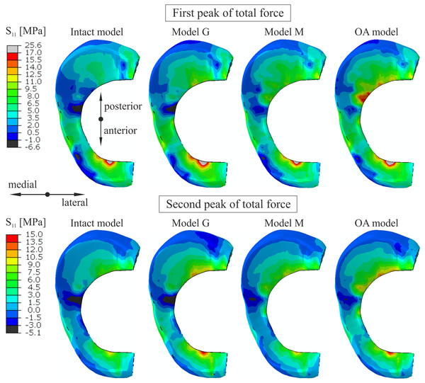 The contour plots of the hoop stress on the proximal surface of the medial meniscus.