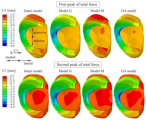 The contour plots of lateral(+)/medial(-) translation measured relative to the tibia on the proximal surface of the medial meniscus.