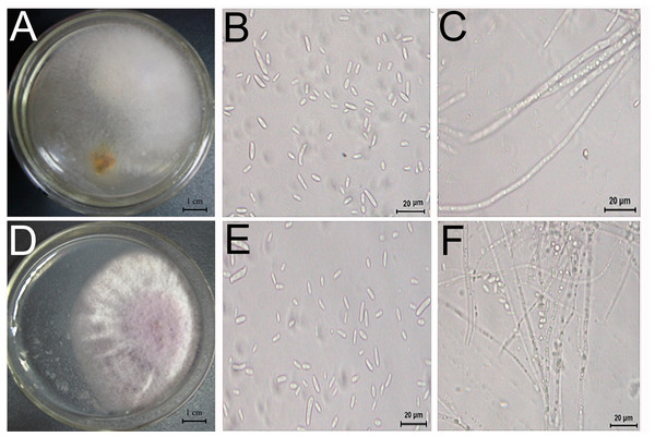 Morphology and microstructure of pathogenic fungi.
