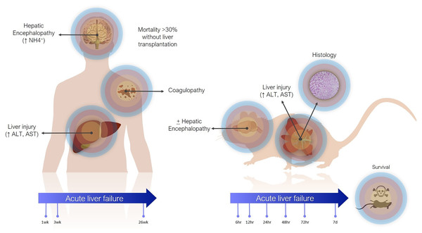 Differences between clinical and preclinical models of acute liver failure.