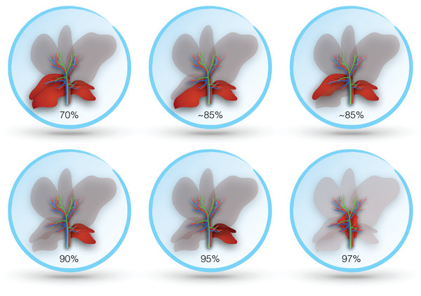 Lobes resected in different murine models of post-hepatectomy liver failure.