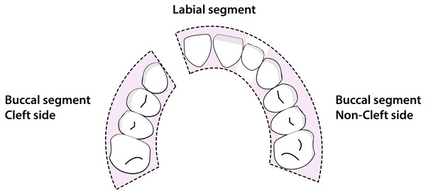 Maxillary arch segments used for the Modified Huddart-Bodenham scoring.