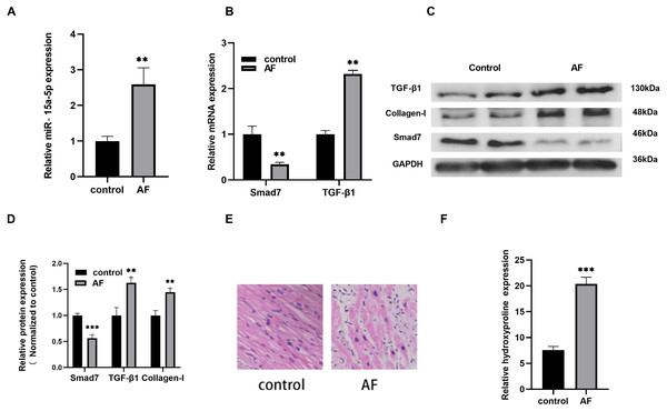 The expression level of miR-15a-5p and Smad7 in LAA tissues.