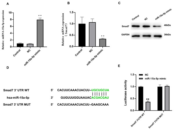Smad7 was a direct target of miR-15a-5p.