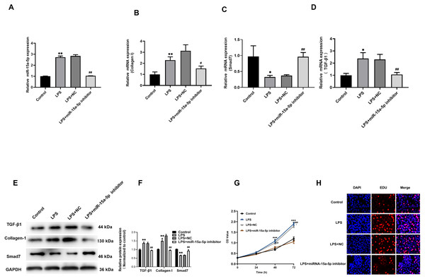 Down-regulated of miR-15a-5p can inhibit collagen I and promote Smad7 expression.