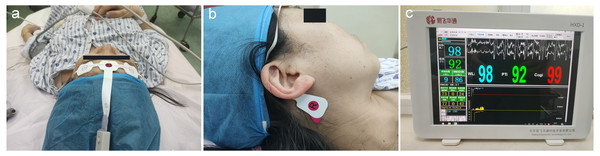 Placement of EEG electrodes and display of Pi.