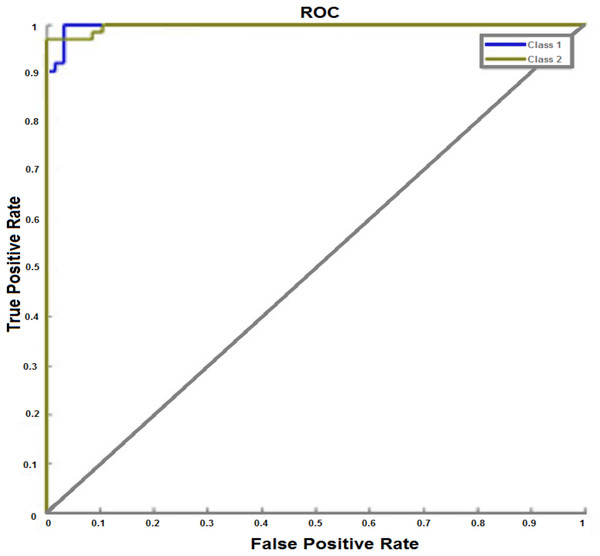 ROC curve with test dataset of breast cancer.
