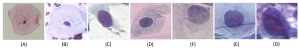 Single cell Images from the Herlev Dataset, categorized into seven classes and shown as (A) superficial squamous epithelia, (B) intermediate squamous epithelia, (C) columnar epithelial, (D) mild squamous non-keratinizing dysplasia, (E) moderate squamous non-keratinizing dysplasia, (F) Severe squamous non-keratinizing dysplasia, (G) squamous cell carcinoma in situ.