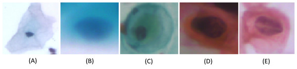 Single-cell images from the SIPaKMeD Dataset, categorized into five classes: (A) Superficial-Intermediate cells, (B) Parabasal cells, (C) Metaplastic cells, (D) Dyskeratotic cells, and (E) Koilocytotic cells.