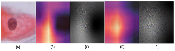 The Binary classification predictions generated using Resnet-101 (trained on Herlev dataset) and Resnet-34 (trained on SIPaKMeD dataset) for a single-cell image.