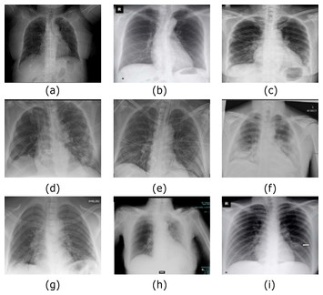 Covid-19: A New Deep Learning Computer-aided Model For Classification 