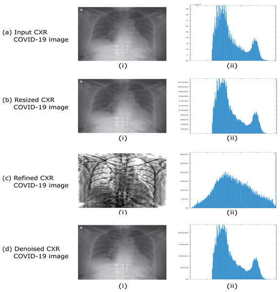 Example of dataset preprocessing steps of raw CXR COVID-19 image.