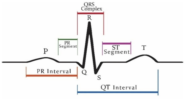 Graphical representation of QRS complex in ECG.