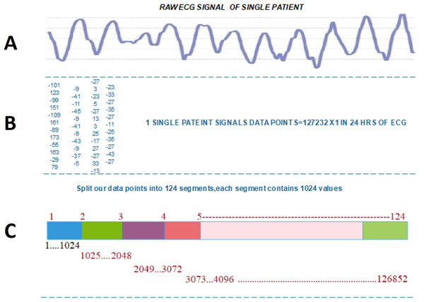 Transforming ECG signal into 124 segments of 1024 values: (A) raw ECG signal, (B) digitized ECG signal, (C) ECG signal segment transformed to image.